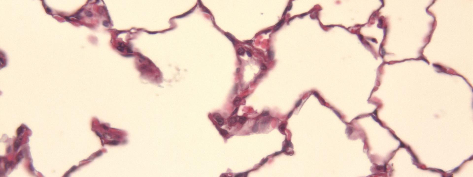 Sectional of lung